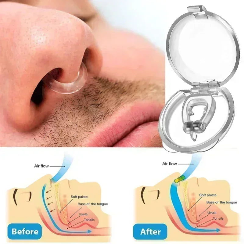 Anti-Snoring Aide, silence snoring.
